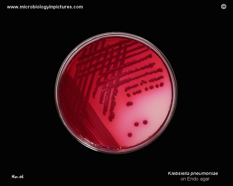 K.pneumoniae on Endo